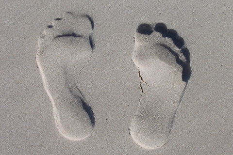 Svullna fötter och ben – orsaker, behandling och bästa stöden