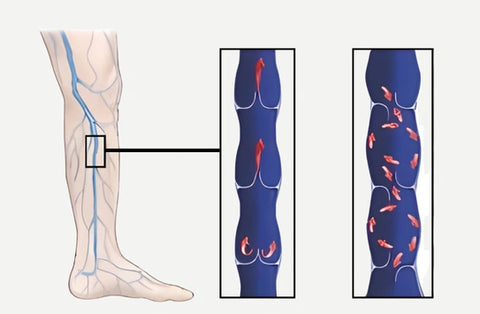 ErgiloPanty - Medicinska kompressionstights